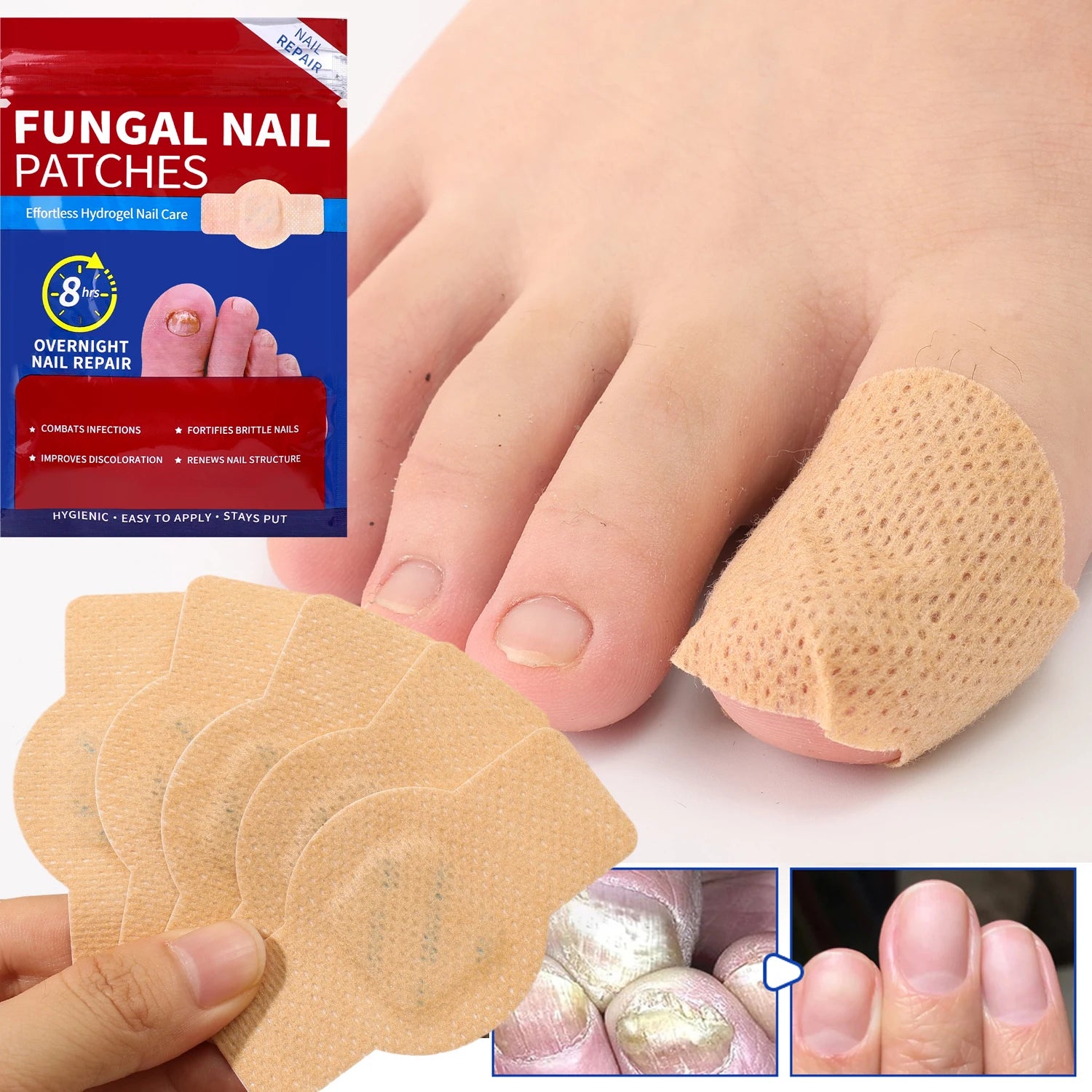 42 Patchs Hydrogel Réparateurs Anti-Mycose Ongles — Imperméable